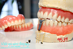 Denture Cleaner - While you were sleeping...  Photography by Lon Casler Bixby - Copyright - All Rights Reserved - www.whileyouweresleeping.photography/